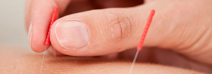 Chiropractic Lake Elmo MN Kary Chiropractic Acupuncture Chiropractic Lake Elmo MN Kary Chiropractic Acupuncture